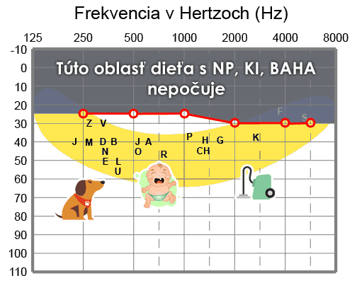 Zisková krivka, dobrá - dopad na reč