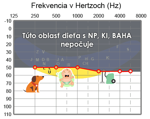 Zisková krivka, zlá - dopad na reč