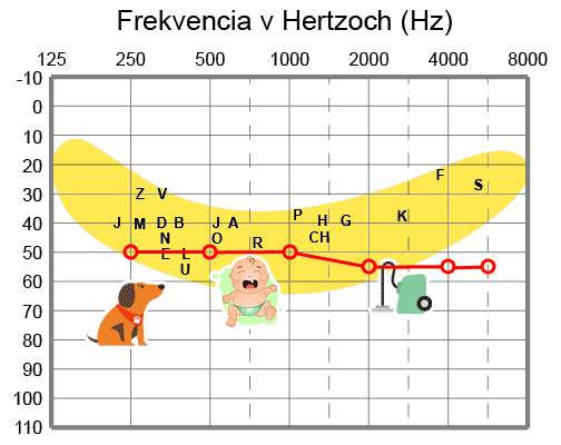 Audiogram