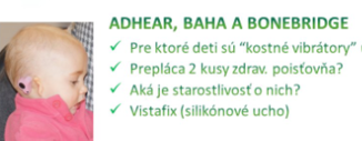 Webinár o sluchových pomôckach - BAHA, ADHEAR a BONEBRIDGE 