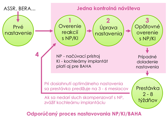 Proces nastavovania načúvacích prístrojov, kochleárnych implantátov, BAHA